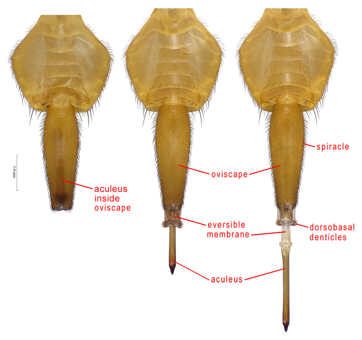 Female abdomen, ventral