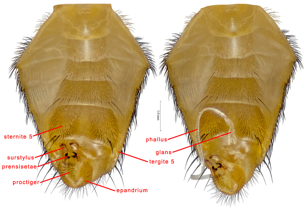 Male abdomen, ventral